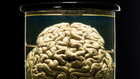Cosa ti dice il cervello?